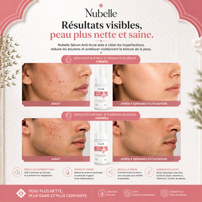 Nubelle™ | Sérum Anti-Acné